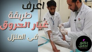 الطريقة الصحيحة لغيار الحروق عمليا Burn dressing in proper practical way