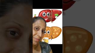 ¡Cuidar nuestro hígado es esencial para mantener una buena salud! 🥦🥕 #higadograso