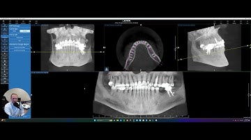 7.0: Acteon Walkthrough Videos -  CPR Settings