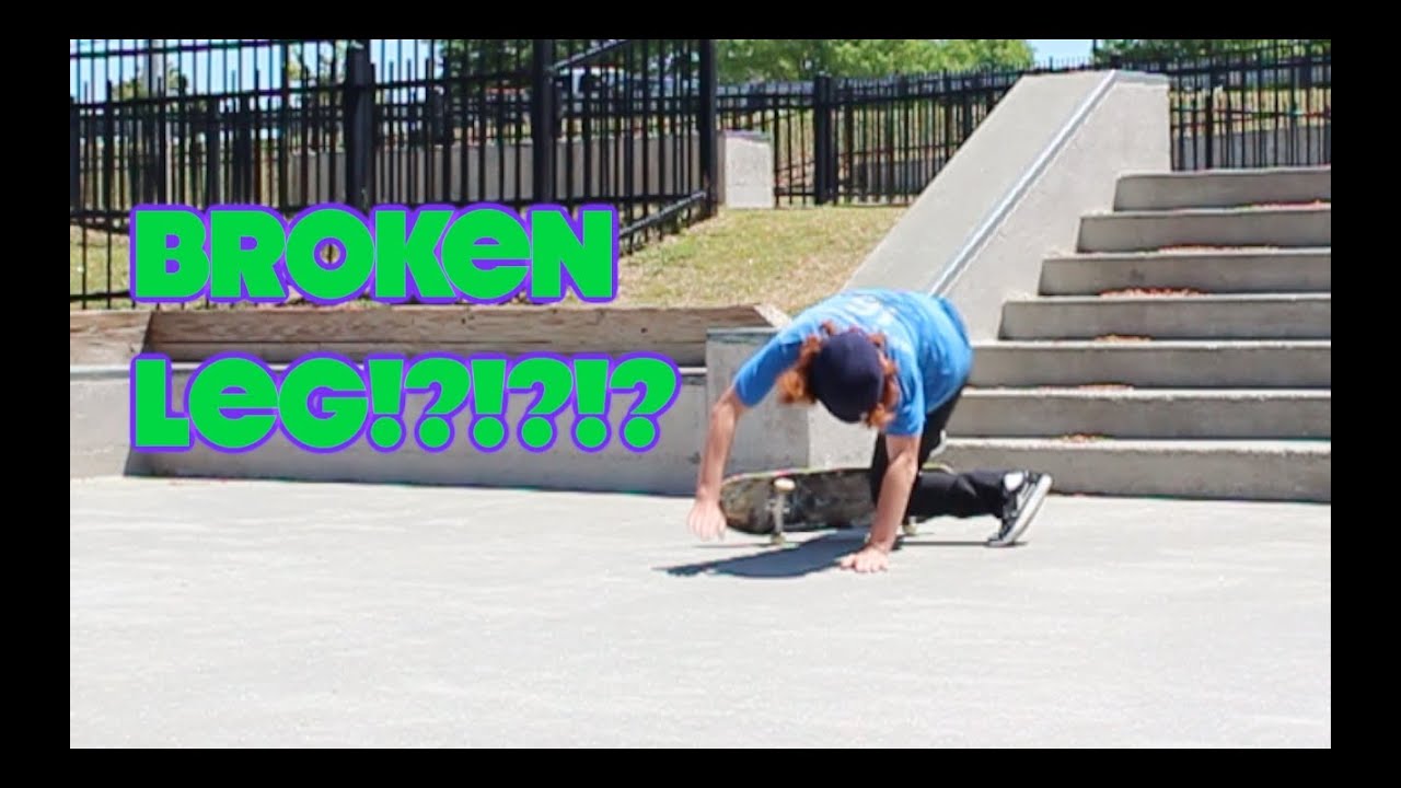 SKATEBOARDER BREAKS LEG?!?!?! YouTube