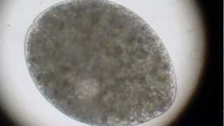 Holophrya and/or Prorodon