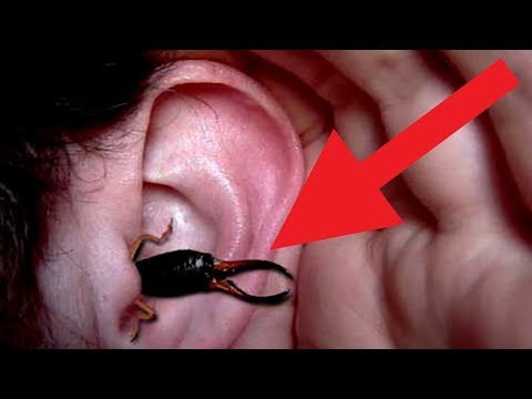 اذا وجدت هذه الحشرة في منزلك عليك الاتصال بالاسعاف