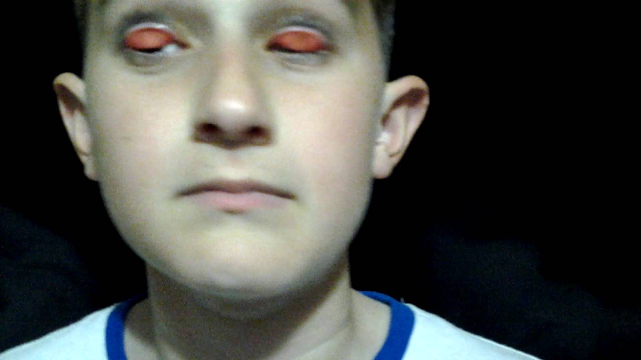 Crazy Kid Eyelid Flipping Youtube