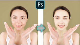 Photoshop CC : Delete acne from the face by Photoshop Design screenshot 2