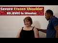 * SEVERE * Frozen Shoulder RELIEVED In Minutes (REAL TREATMENT!!!!)