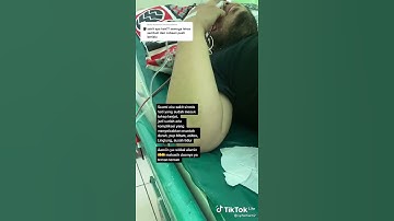 SIROSIS KERUSAKAN HATI  #INFO SELENGKAPNYA :  #Hub. KLINIK ALTERNATIVE WIENARTO, S.Pd.  SOWAN LOR (B