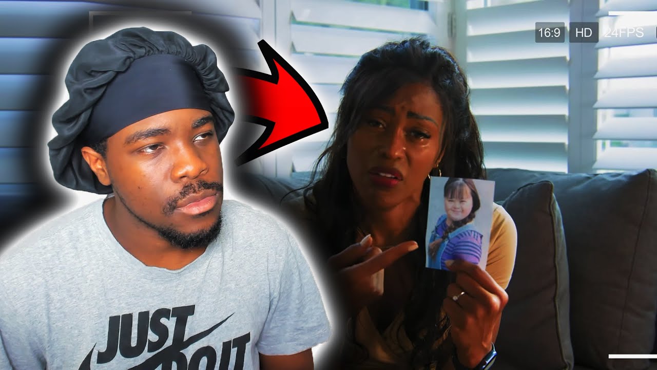 YouTubers USE KID With DOWN SYNDROME For VIEWS Reaction