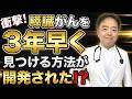 膵がんを3年早く発見できる検査が開発された?【専門医解説】