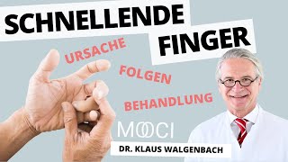 Schnellender Finger - Ursachen und Behandlung für Schnappfinger!