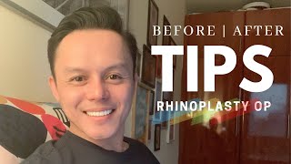 TIPS ON BEFORE & AFTER RHINOPLASTY OPERATION