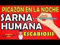 SARNA HUMANA | ESCABIOSIS ¿Cómo se contagia? Síntomas, Diagnóstico y Tratamiento 📝RESUMEN