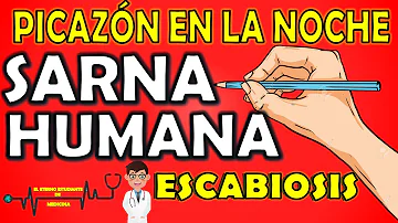 ¿Cuánto tiempo se puede tener sarna sin saberlo?