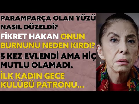 HÜMEYRA ''Kocasından defalarca dayak yiyip hastanelik olan bir yıldızın hikayesi.''