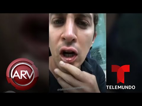 Vídeo: Jonathan Islas Mostra Teste De Drogas Negativo