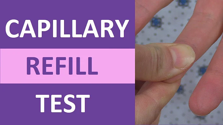 Capillary Refill Time Test: Normal vs Abnormal - Nursing Clinical Skills