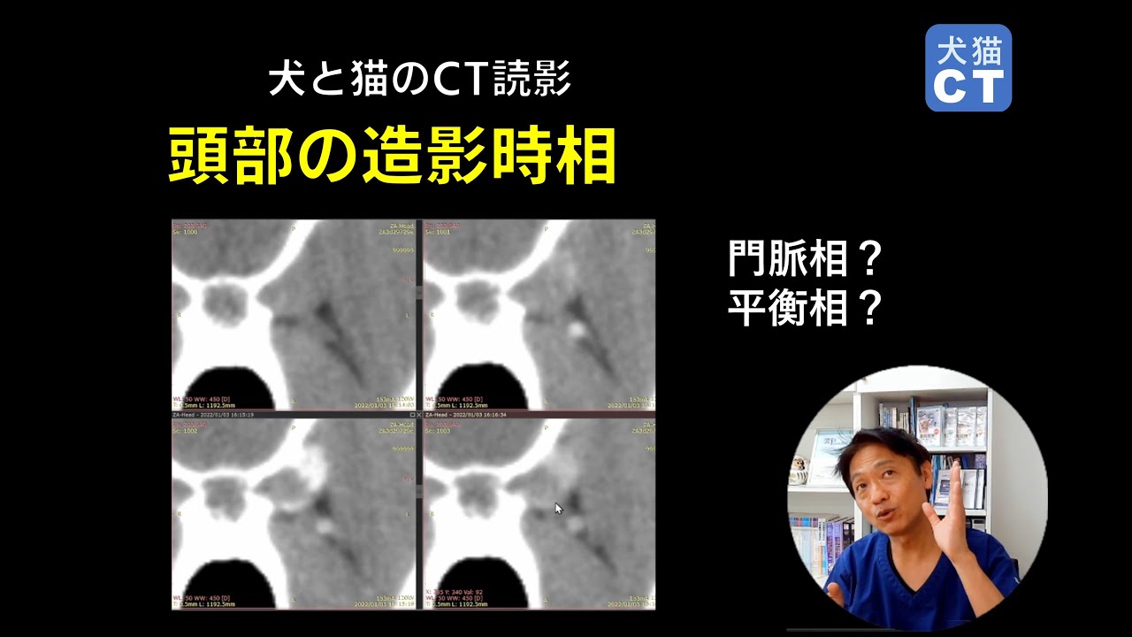 頭部の画像で時相を判断するにはどうしたらよいでしょうか - YouTube