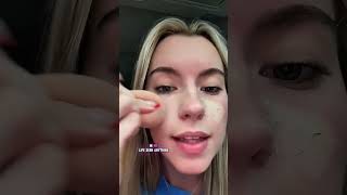 NOBODY TOLD ME PIMPLE PATCHES WORKED THIS FAST