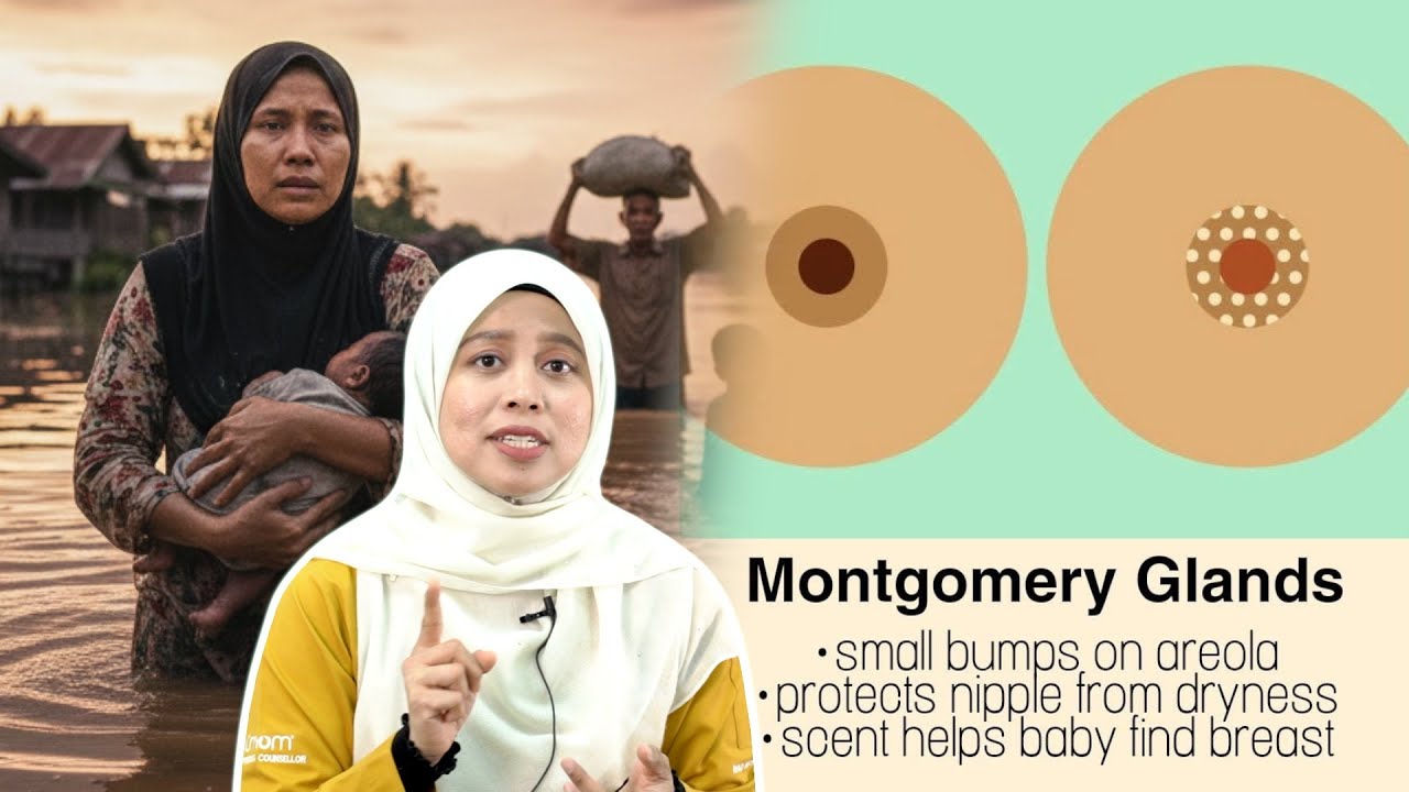 Menyusu Masa Banjir: Susu Badan atau Botol?