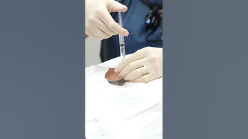 An epidural injection for low back pain