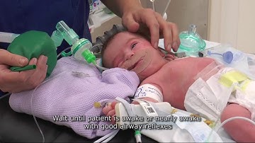 Paediatric Anaesthetics: Chapter 4 - Extubation neonate