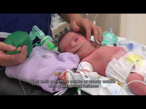 Paediatric Anaesthetics: Chapter