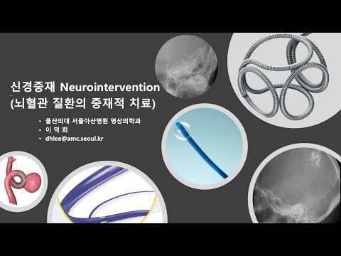 [학생강의2019] 뇌혈관 질환의 신경중재 시술 (Neurointervention) 기초 강의 (서울아산병원 이덕희 교수)