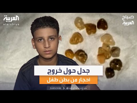 جدل بين اختصاصي طب المسالك البولية ووالدة الطفل عاطف حول خروج الأحجار الكريمة من بطن ابنها
