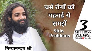 चर्म रोग (Skin Problems) को समझें ताकि इसका सही इलाज कर सकें - नित्यानंदम श्री