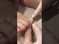 【高齢者の爪切り】#高齢者施設 #爪切り