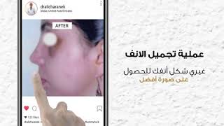 change the shape of your nose BY DR ALI CHARANEK