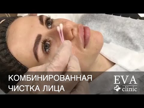 Комбинированная чистка лица