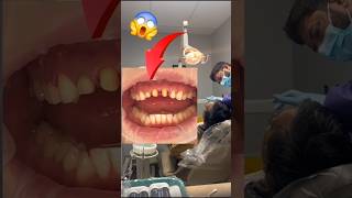 #dentalcare #teeth #dentist