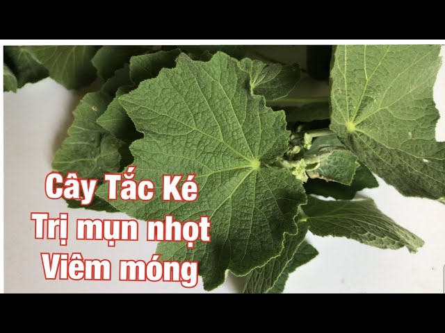 ĐTT Thủy | Trị viêm khóe móng tay chân không tốn tiền hiệu quả class=