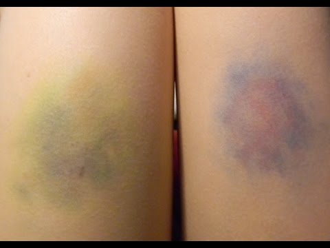How to: Bruises with Eye Shadows