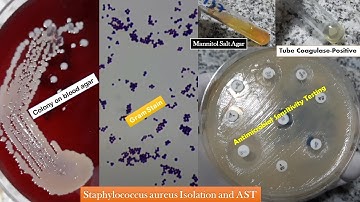 Staphylococcus aureus golden yellow colonies, Gram stain, Coagulase test, Growth on MSA and AST
