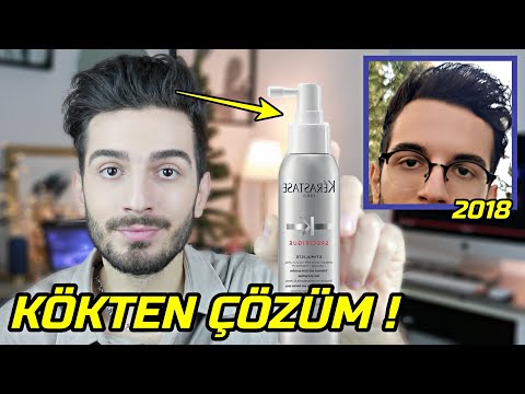 SAÇ DÖKÜLMESİNE KÖKTEN ÇÖZÜM ! 2 YILLIK DENEYİMİM Dökülen Saçları Yeniden Çıkartma │ Güzellik Bakım