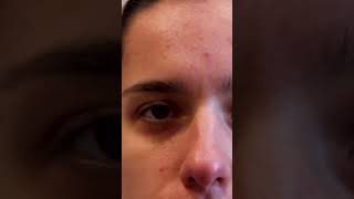 🌟 Άμεσο Boost Λάμψης & Ανανέωσης με την AHA Refining Ampoule της Reviderm!