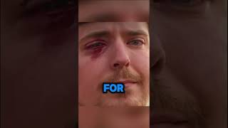 We Saved MrBeast From Being BLIND! Wealth