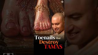 Divine Mothers toenails that removes Darkness! @SadhanaApp