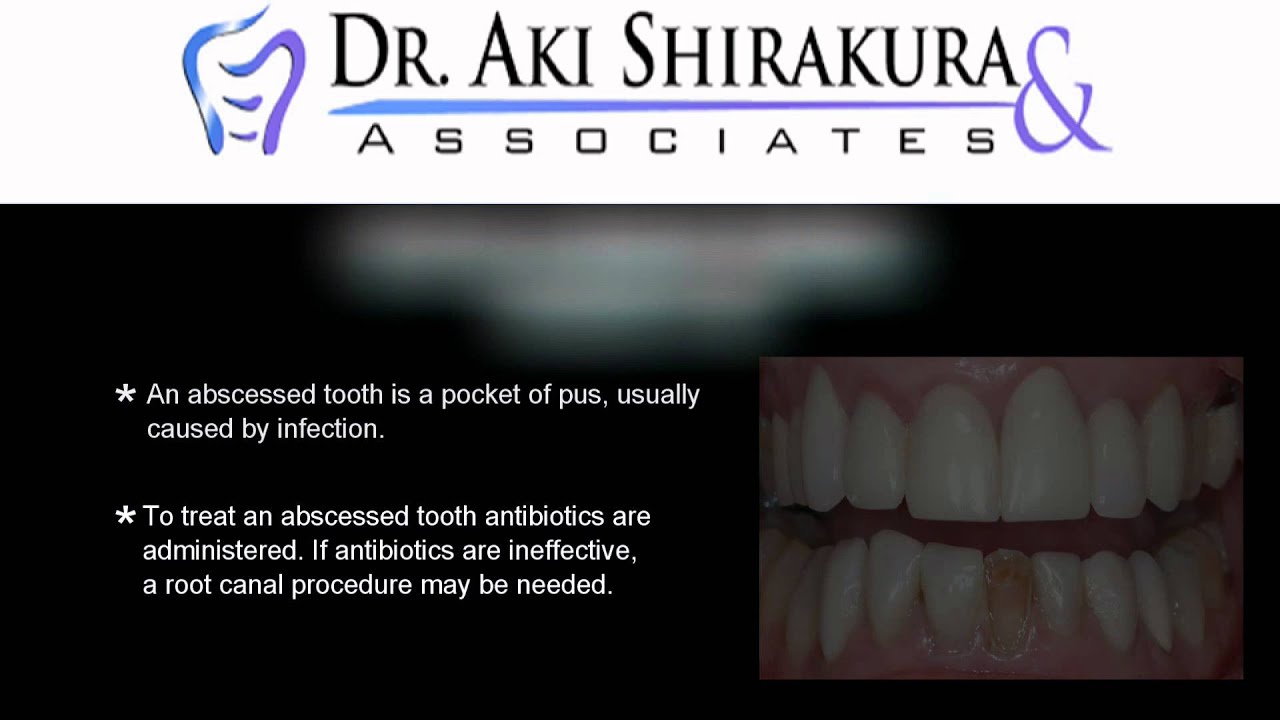 Cosmetic Dentist Westchester NY Common Dental Problems YouTube