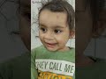 Best Doctor for Cleft Lip Operation in India ? | Dr Parit Ladani