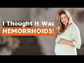 I Had CANCER my Entire Pregnancy and Thought the Bleeding was NORMAL! "I felt healthy!"
