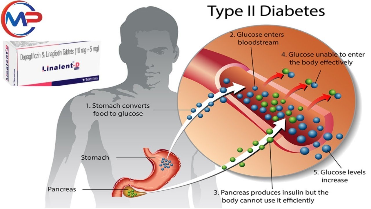 Best Type 2 Diabetes Medicine