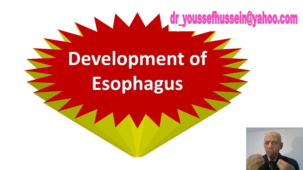 Development and congenital anomalies of esophagus | Tracheoesophageal fistula