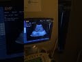 Demo Emp 3000 Color Doppler, Nothing matter but imaging, Best price in Pakistan