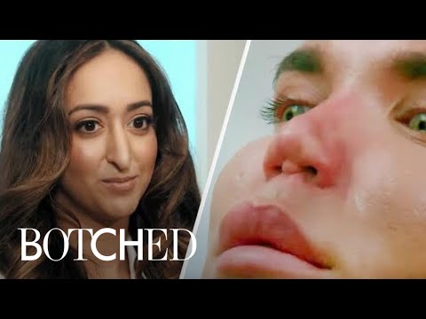 The Most Intense Nose Surgeries From Botched | E!