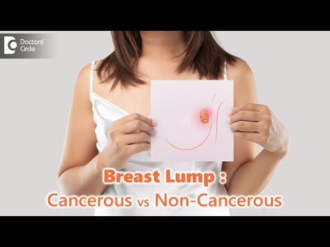 वीडियो: क्या स्तन कैंसर की गांठ को छूने पर दर्द होता है?
