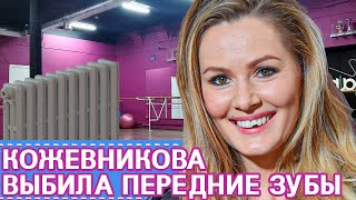 МАРИЯ КОЖЕВНИКОВА выбила передние ЗУБЫ • УНИВЕР АЛЛА • ВИНИРЫ ДЛЯ ЗУБОВ