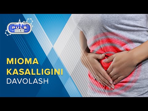 PULS 1141 Mioma kasalligini davolash