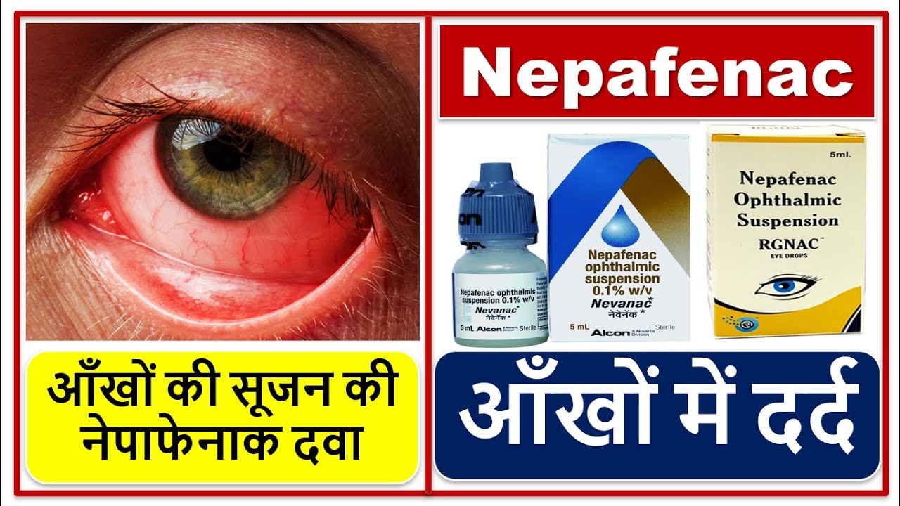 आँखों में दर्द की दवा, आँखों की सूजन की दवा, नेपाफेनाक, Eye pain & Inflammation  Medicine Nepafenac